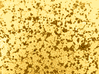 15x Micrograph of DenZbor